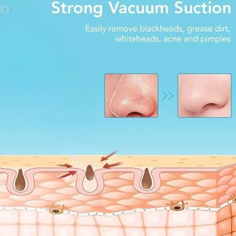 Rechargeable Blackhead Remover Vacuum Cleaner | Model FPLS-001 | Deep Pore Cleansing & Microdermabrasion Device thumbnail 7