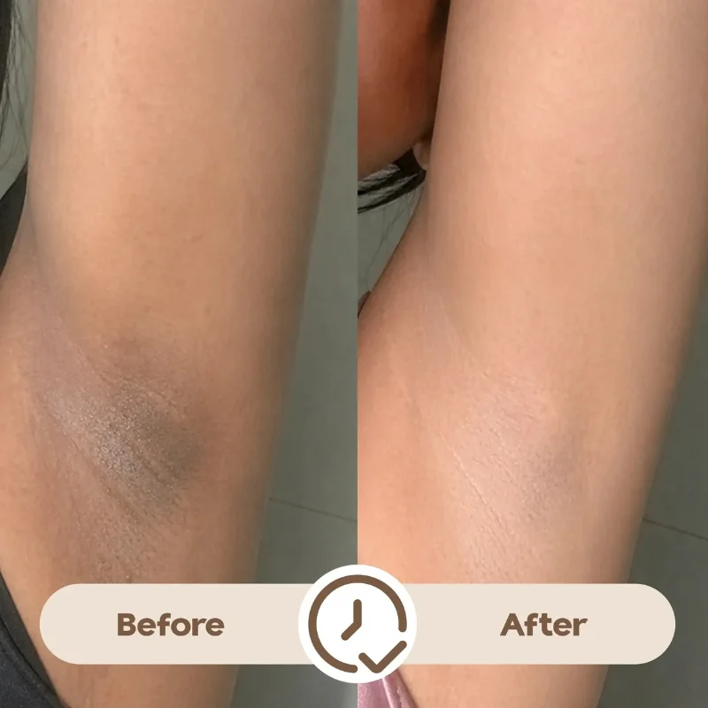Ray Time To Shine Underarm Serum | Brightening Underarm Serum with Niacinamide, Alpha Arbutin & Hyaluronic Acid | Lightweight Daily Care | 30ml thumbnail 5